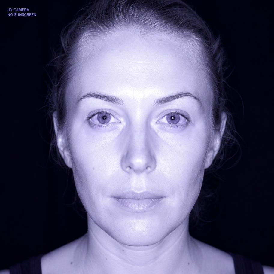 All bright. No protection.
